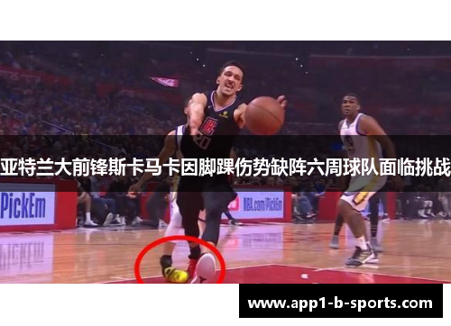 亚特兰大前锋斯卡马卡因脚踝伤势缺阵六周球队面临挑战